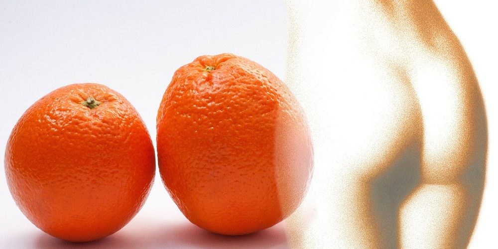 антицелулитна диета